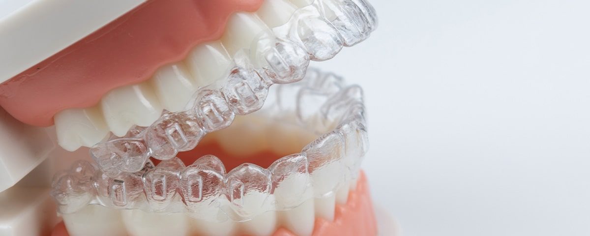 How Invisalign Aligner Removal Techniques Protect Your Enamel Throughout Treatment